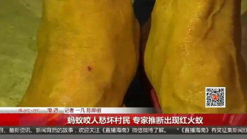 红火蚁入侵村庄 海南澄迈县多人被咬伤,专家建议及时上报